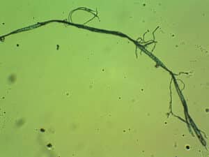 A microscopic view of a filamentous structure with branching, surrounded by numerous small circles and particles on a Howard Payne University greenish background. | HPU